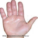 Rimedi naturali per la sudorazione delle mani o iperidrosi palmare