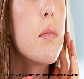 rimedi per cicatrici acne